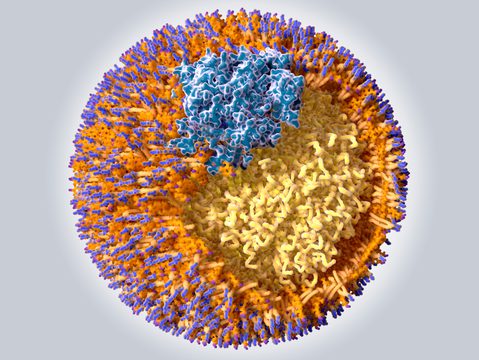 Schnitt durch ein LDL-Partikel. Gelb: Fettmoleküle (Triglyzeride), orange mit lila Köpfen: Cholesterin, Orange mit blauen Köpfen: Phospholipide, blau: Apolipoprotein B 100 